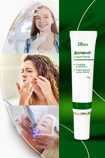 Acnevo Acne Liquid Paste