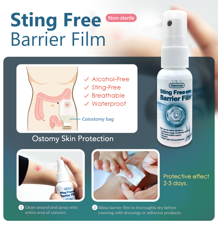 Sting Free Barrier Film (MARSI ) Comprehensive Guide to Wound Care