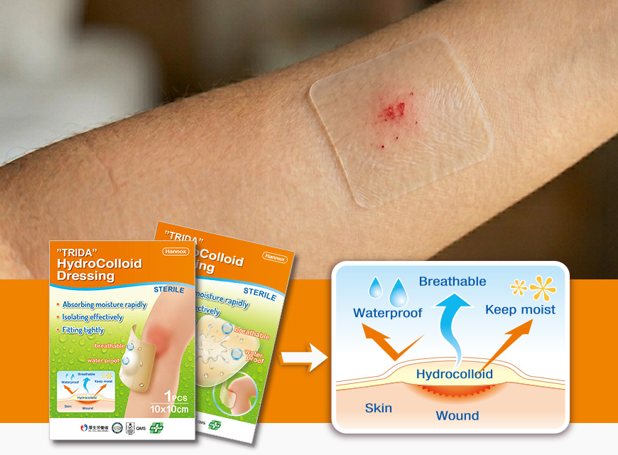 Hydrocolloid Dressing