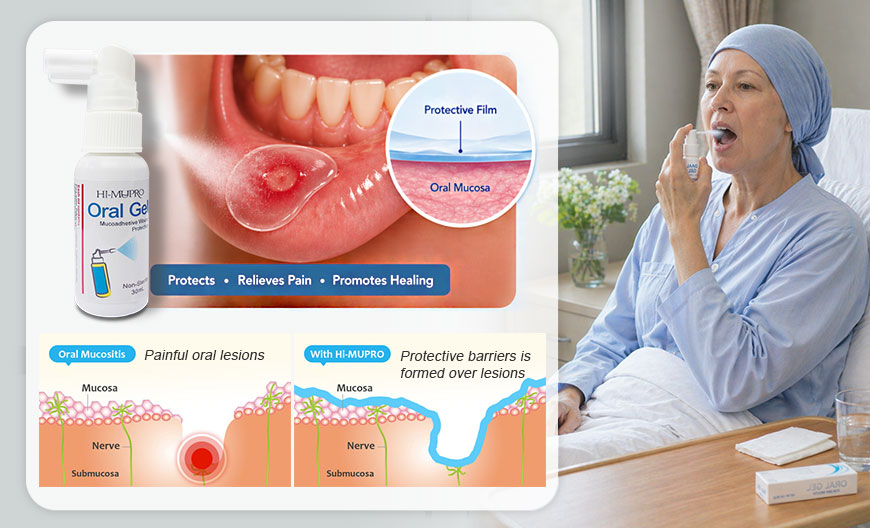 Gel en spray oral HI-MUPRO